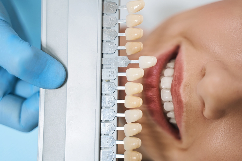 Contact Seibert Complete Dentistry. Woman at front desk of cincinnati office.